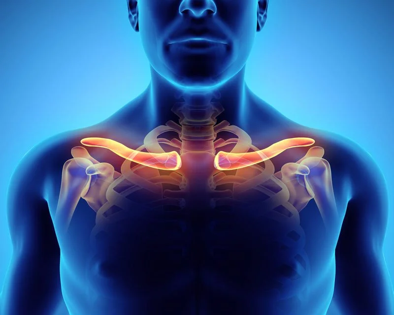 Thoracic outlet syndrome anatomy showing compressed nerves and vessels