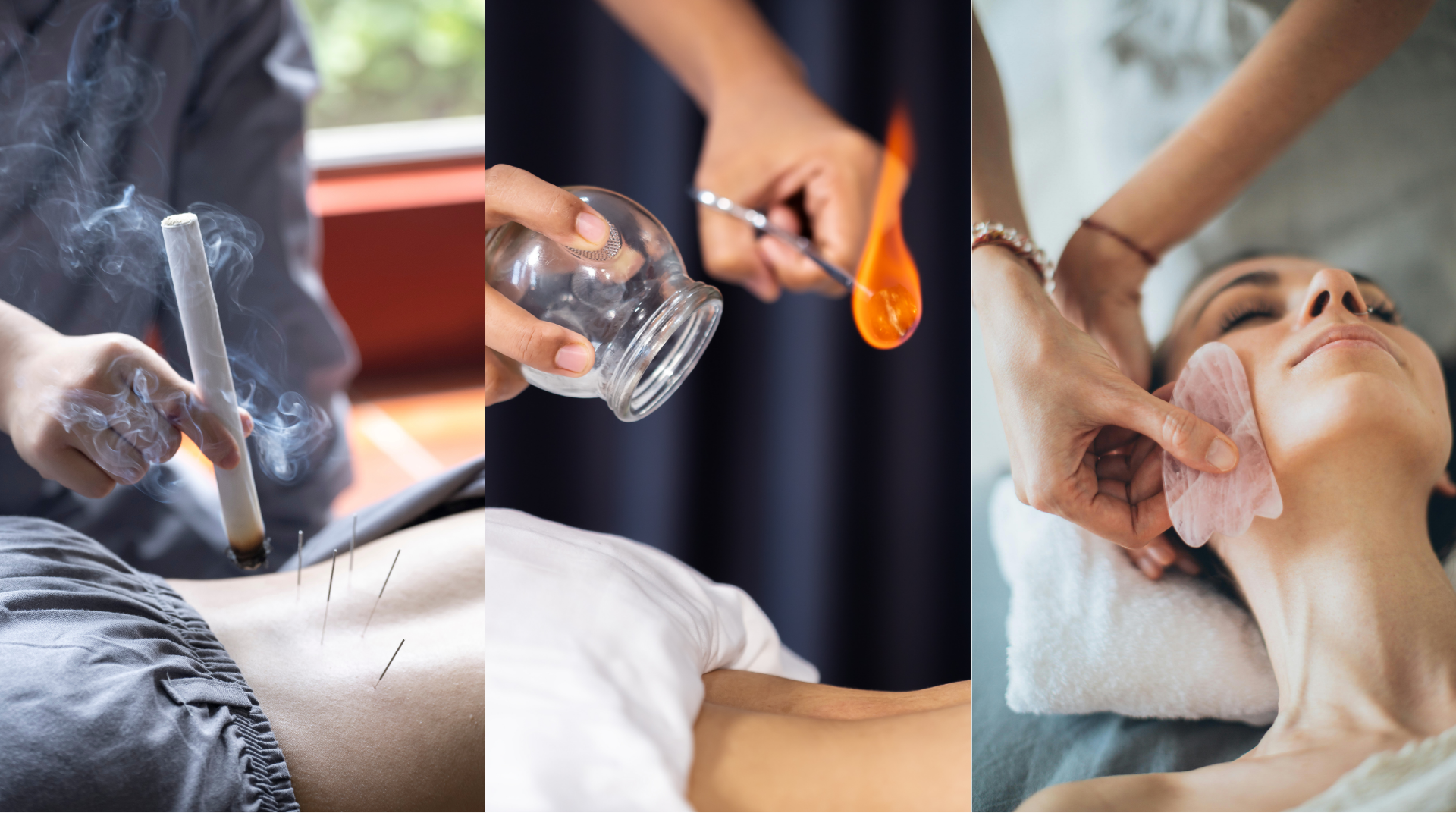 Cupping, Moxibustion and Gua Sha treatments
