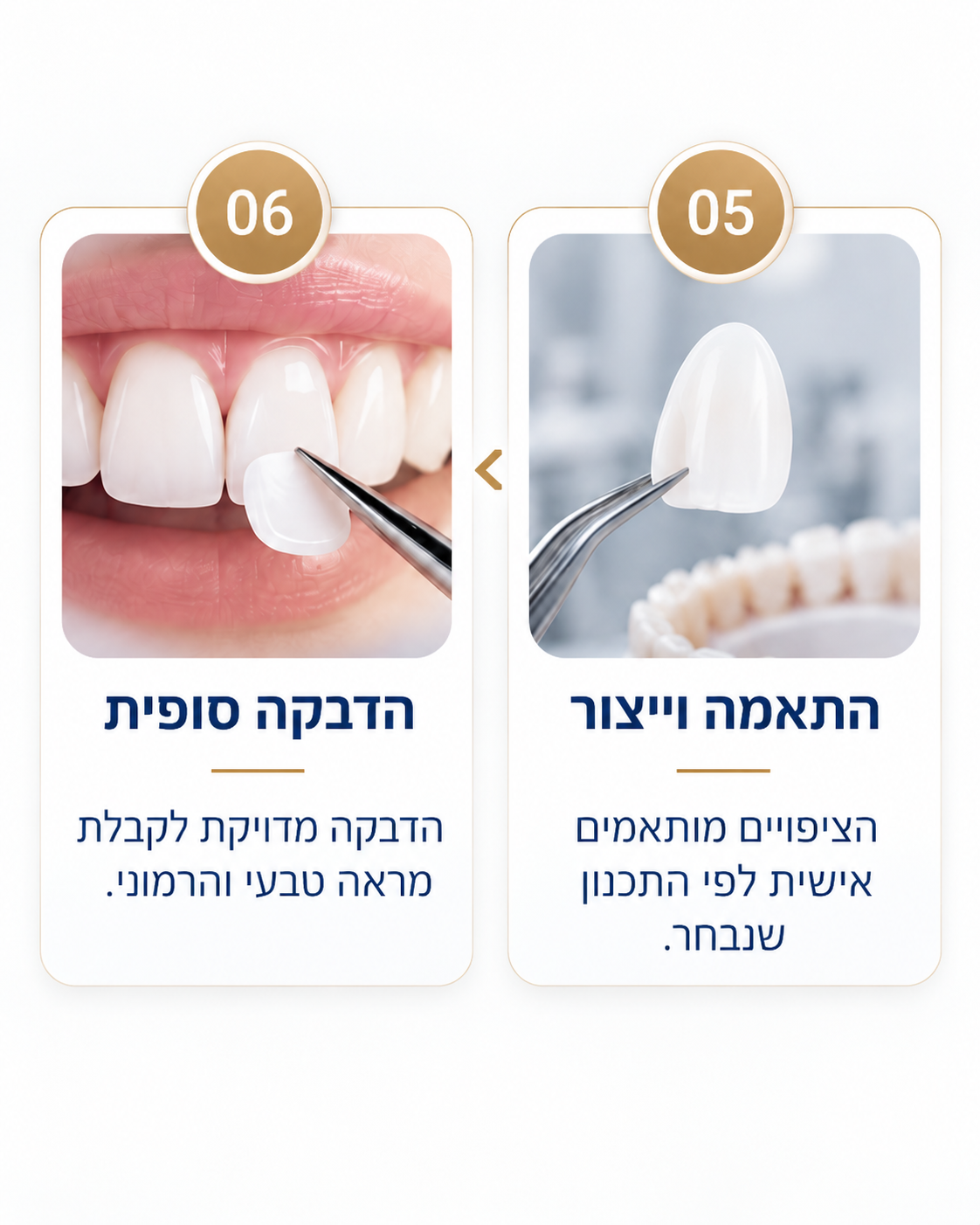 שלבי ציפוי שיניים 05 ו-06: התאמה וייצור אישי של הציפויים, והדבקה סופית לקבלת מראה טבעי והרמוני