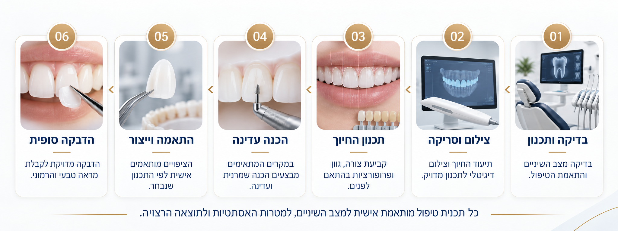 שלבי תהליך ציפוי שיניים משלב הבדיקה והתכנון ועד ההדבקה הסופית
