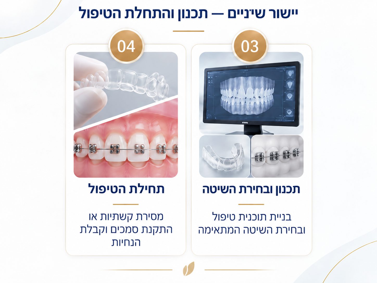 שלבי תהליך יישור שיניים 03 ו-04: תכנון ובחירת השיטה עם קשתיות שקופות או סמכים, ותחילת הטיפול ומסירת ההנחיות