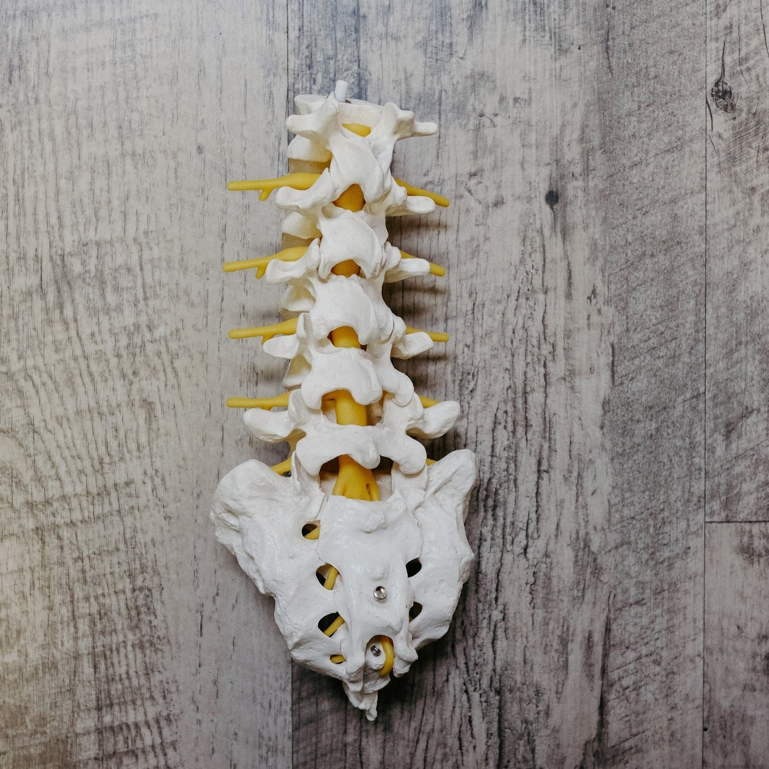 The Importance of X-Rays at Lake Nona Chiropractic - Scoliosis article from Lake Nona Chiropractic