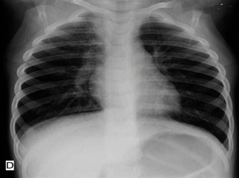 Radiologia pediátrica em análise