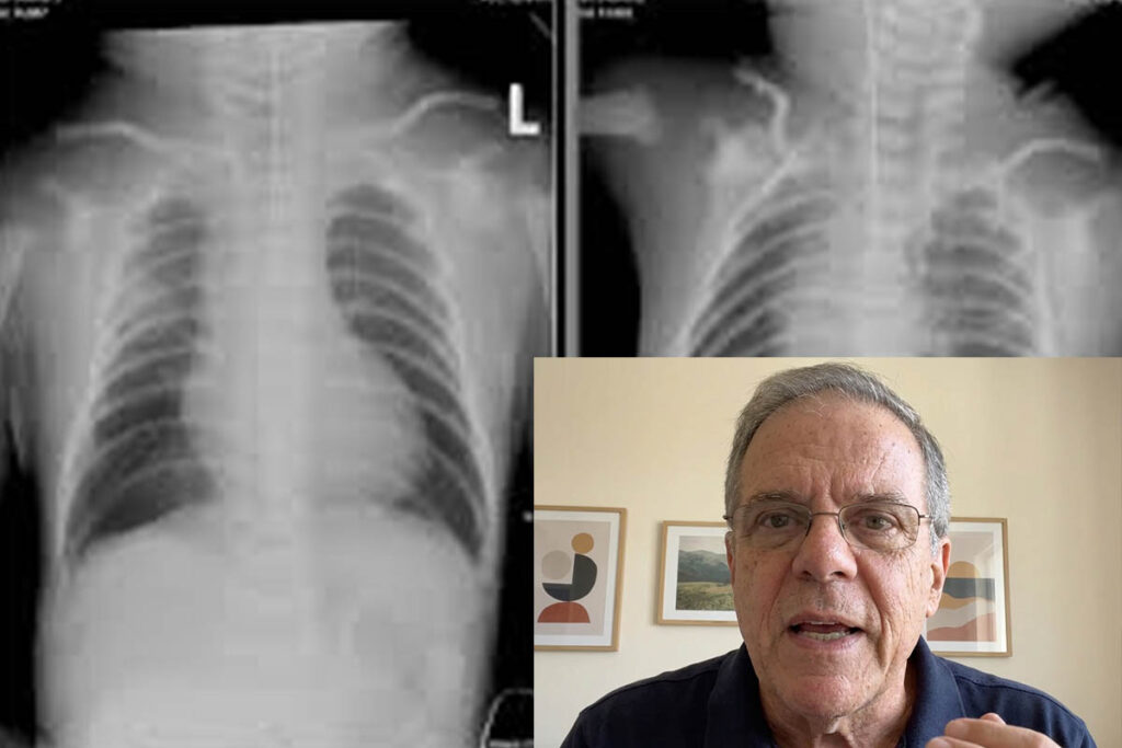 Correção individual em vídeo, pelo Dr. Pedro Daltro,