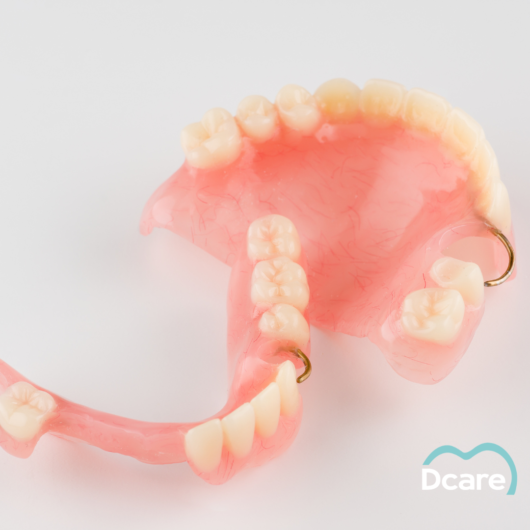 Prótesis dental