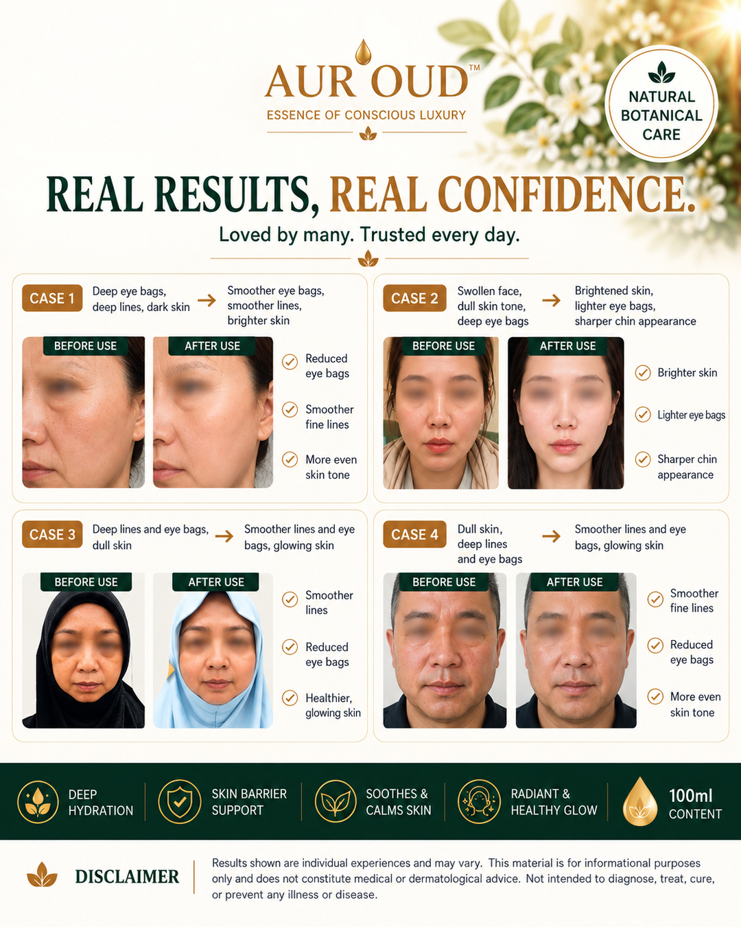 AUR'OUD™ Real Results Real Confidence 4-Case Testimonial Flyer