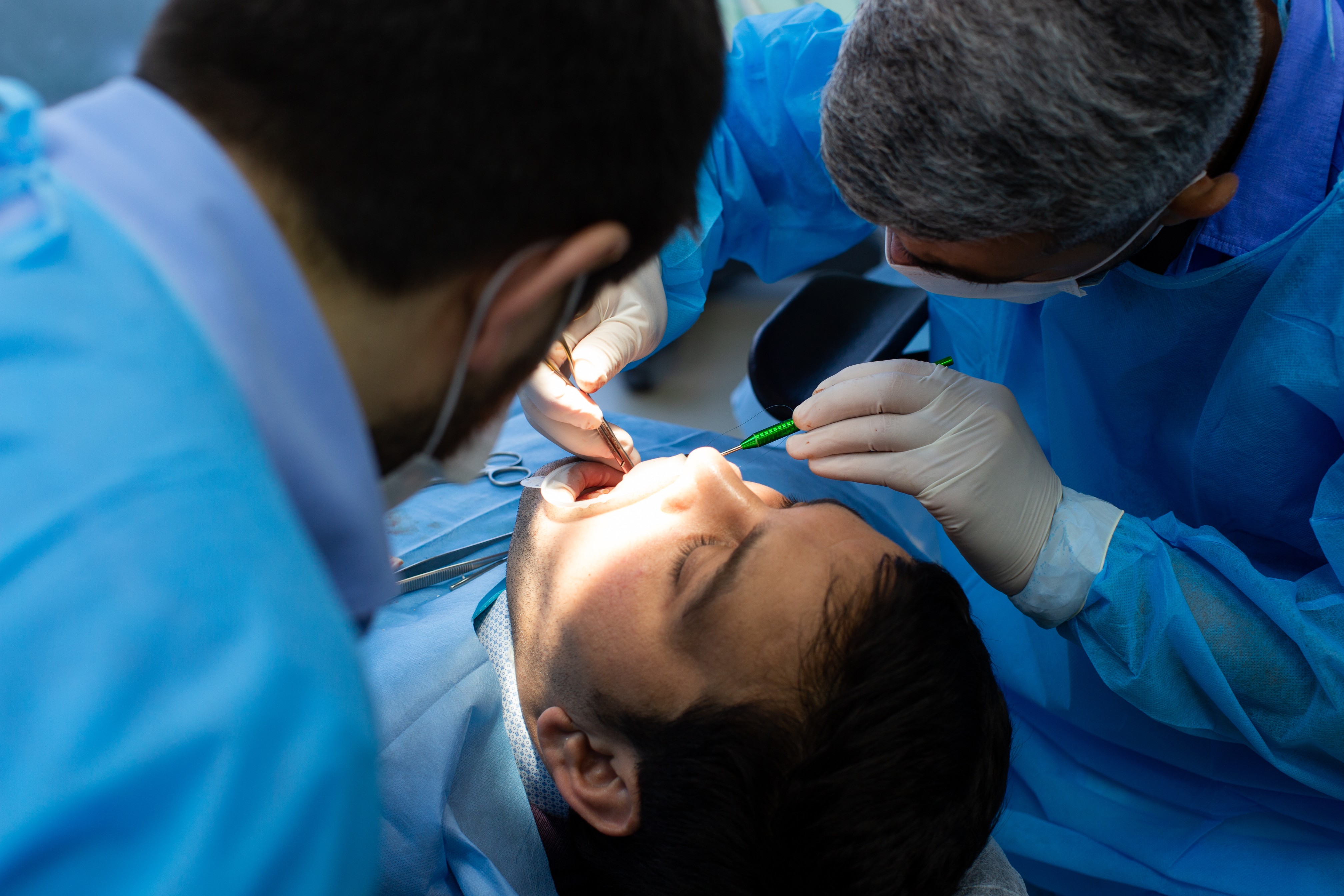 Tooth extraction procedure in progress