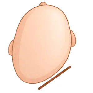 Ilustração representando Plagiocefalia, tipo de assimetria craniana