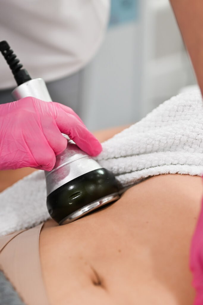 Venus Legacy en Vizage Aesthetic Center en Doral, FL