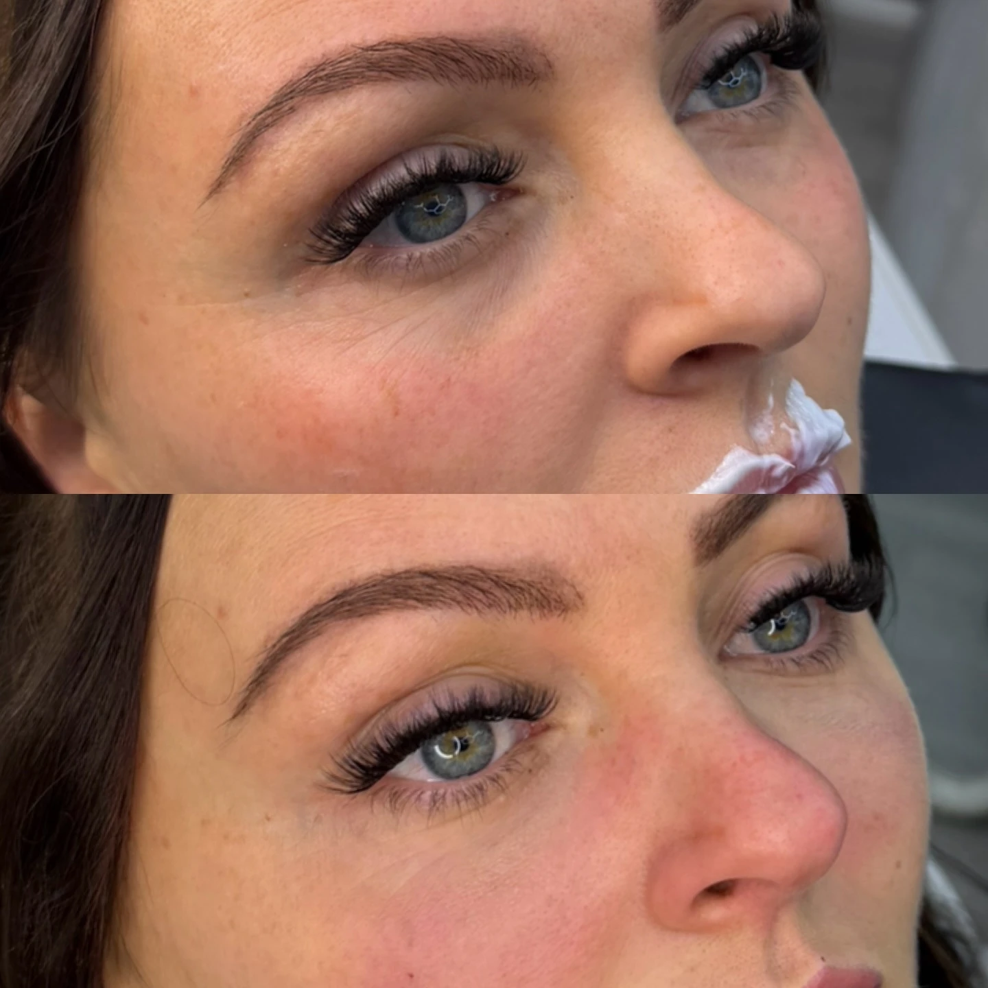 Real Tear Trough Result 1 at Burns Salon Luton