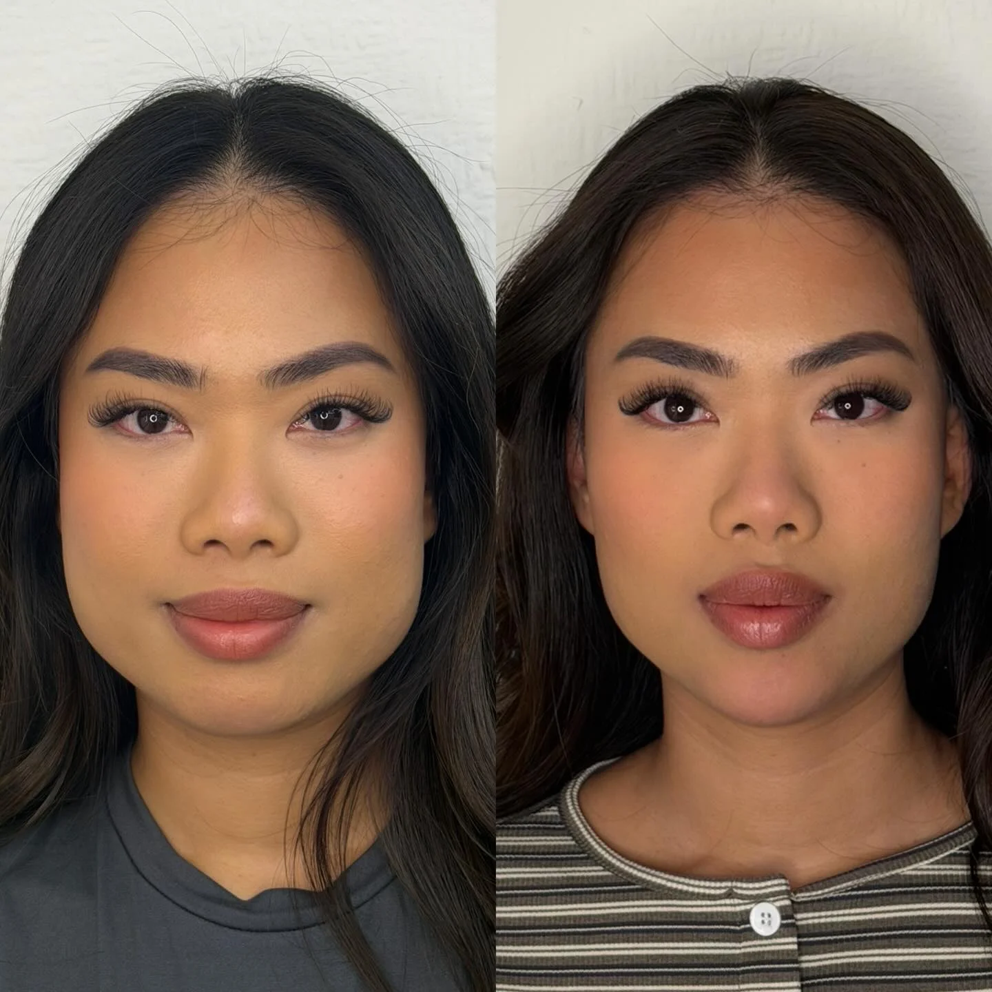 Real Facial Slimming Result 1 at Burns Salon Luton
