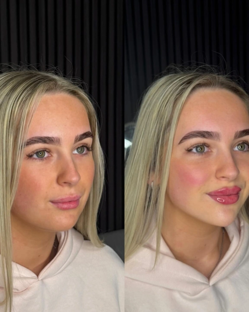 Natural Volume — Signature Lips