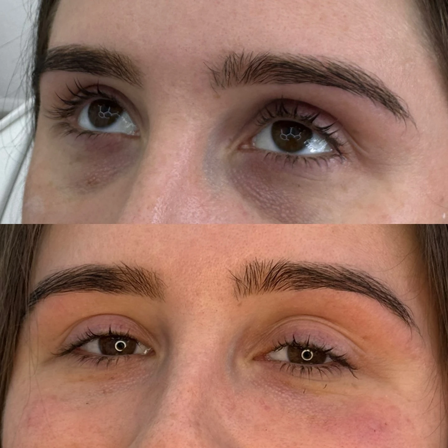 Real Tear Trough Result 3 at Burns Salon Luton