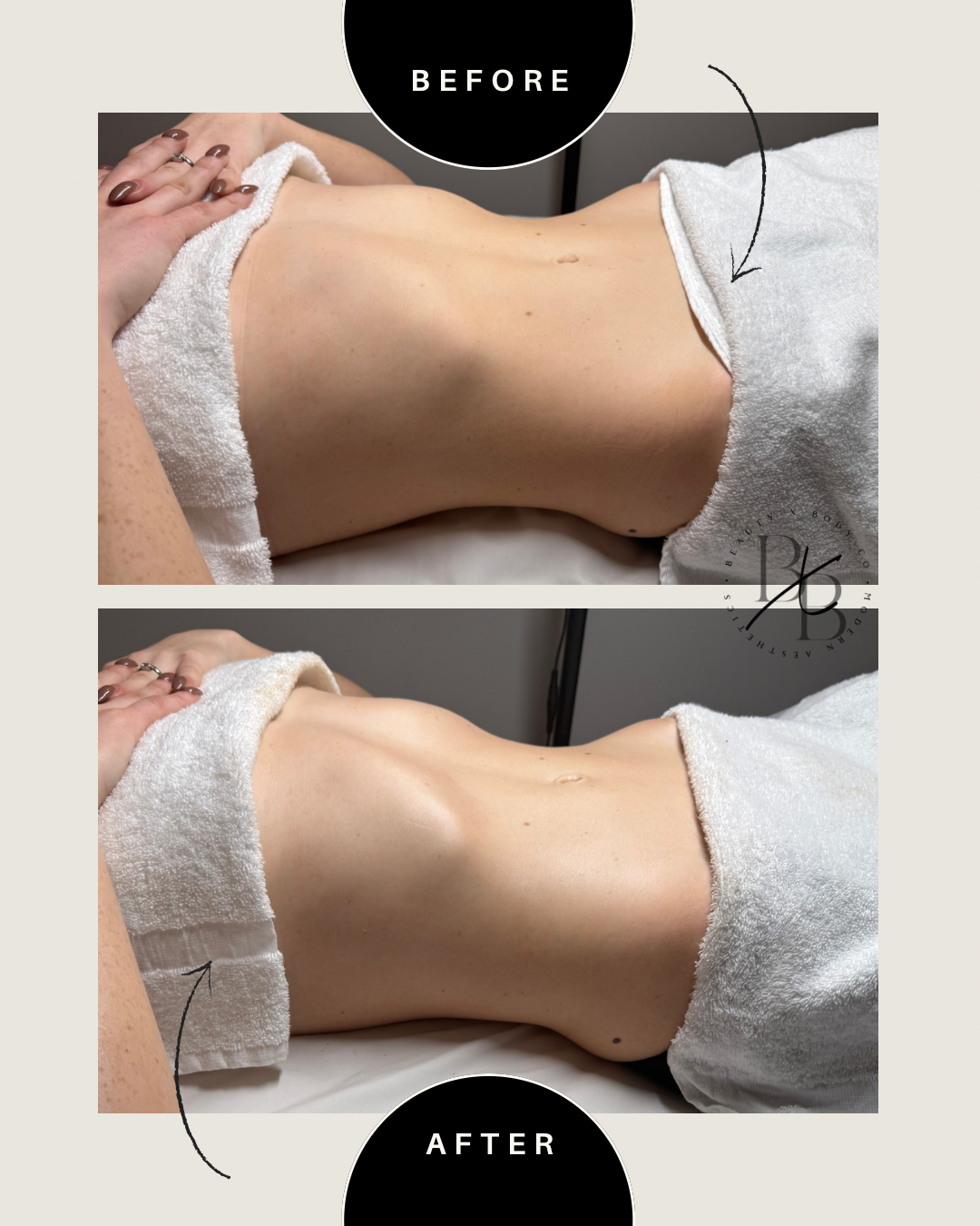 Client result showing smooth natural contours