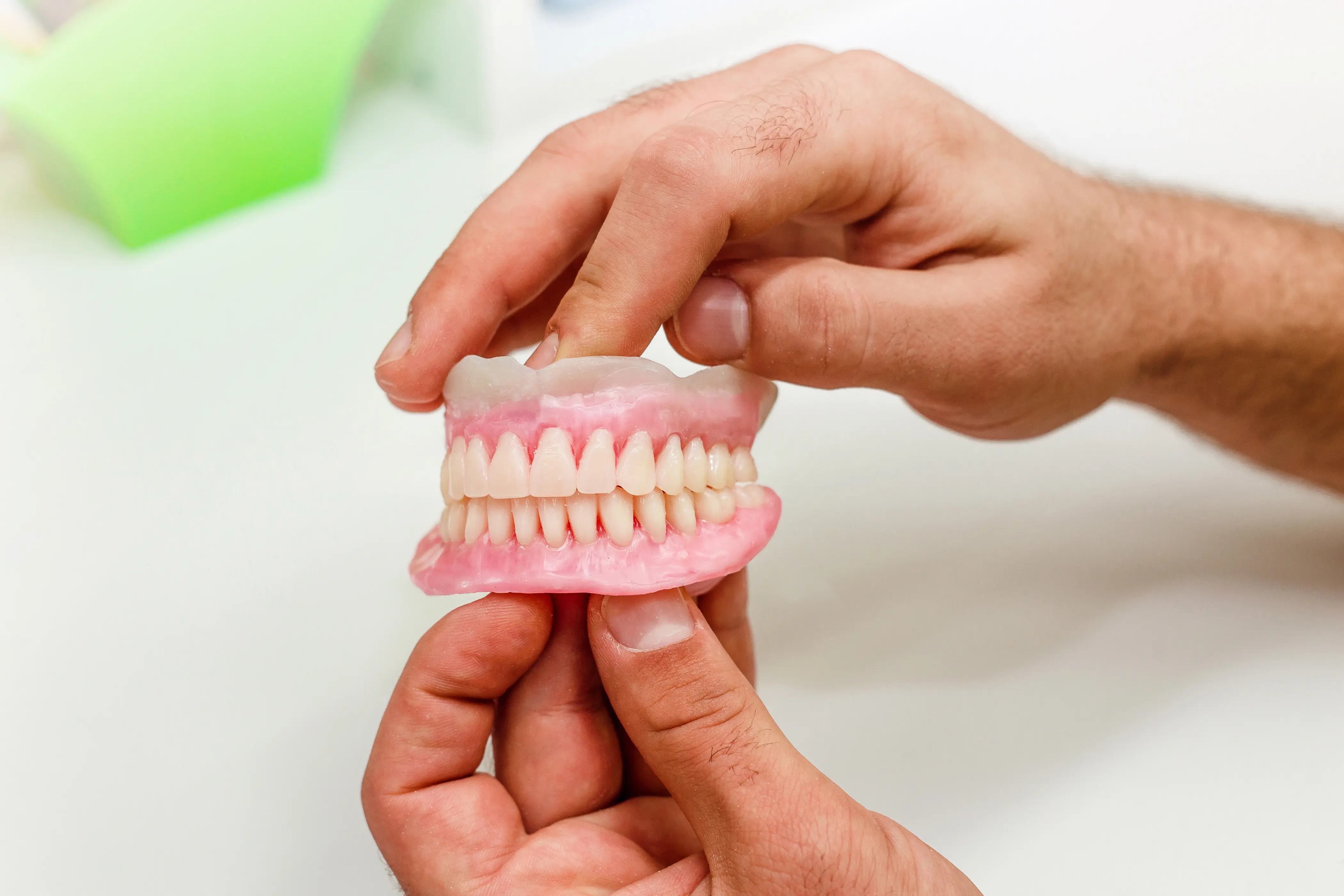 Prothèse amovible terminée avec un ajustement anatomique précis au cabinet Avenue Dental Budapest
