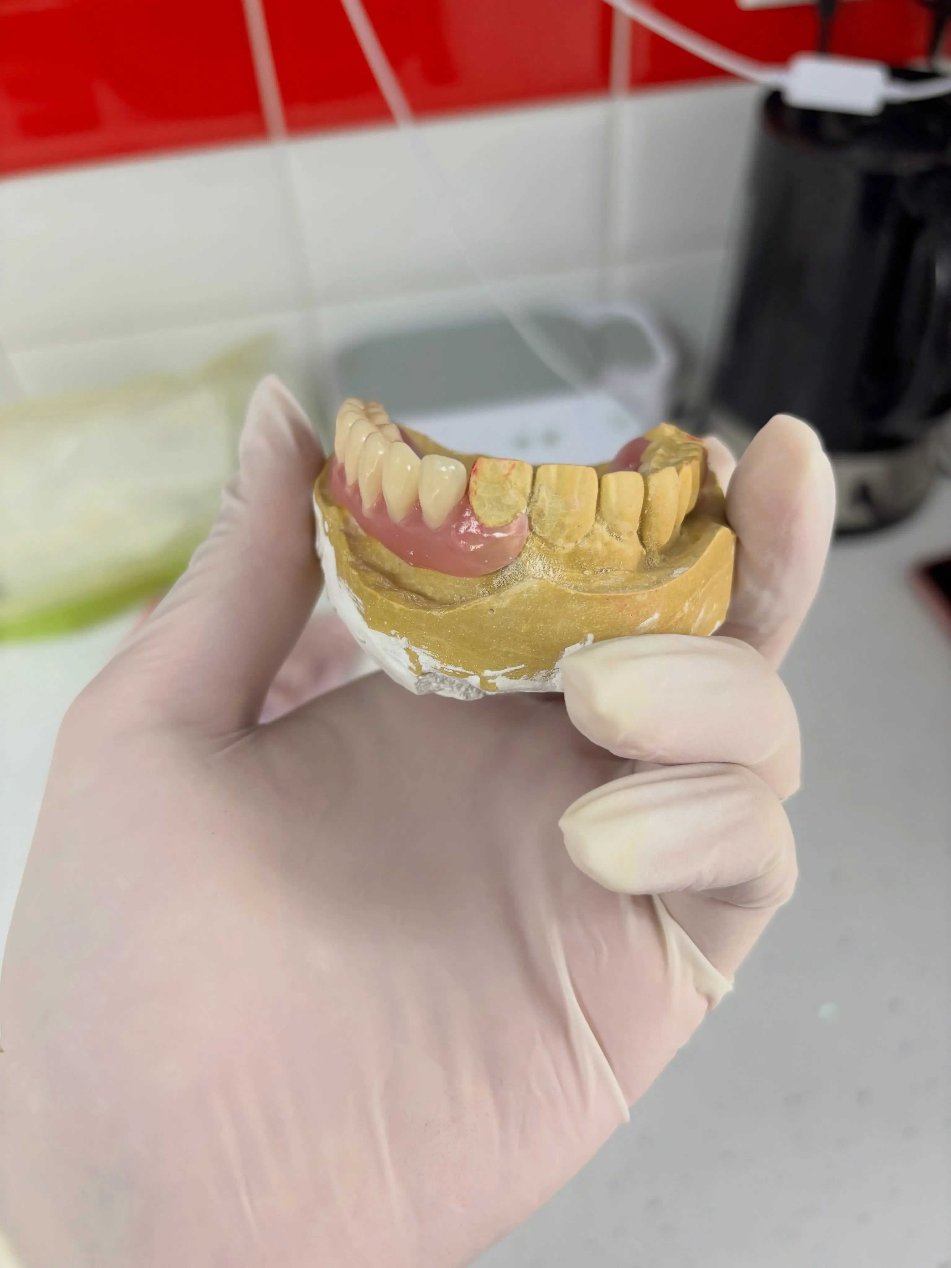 Chirurgien-dentiste tenant une prothèse amovible inférieure usinée avec précision au cabinet Avenue Dental