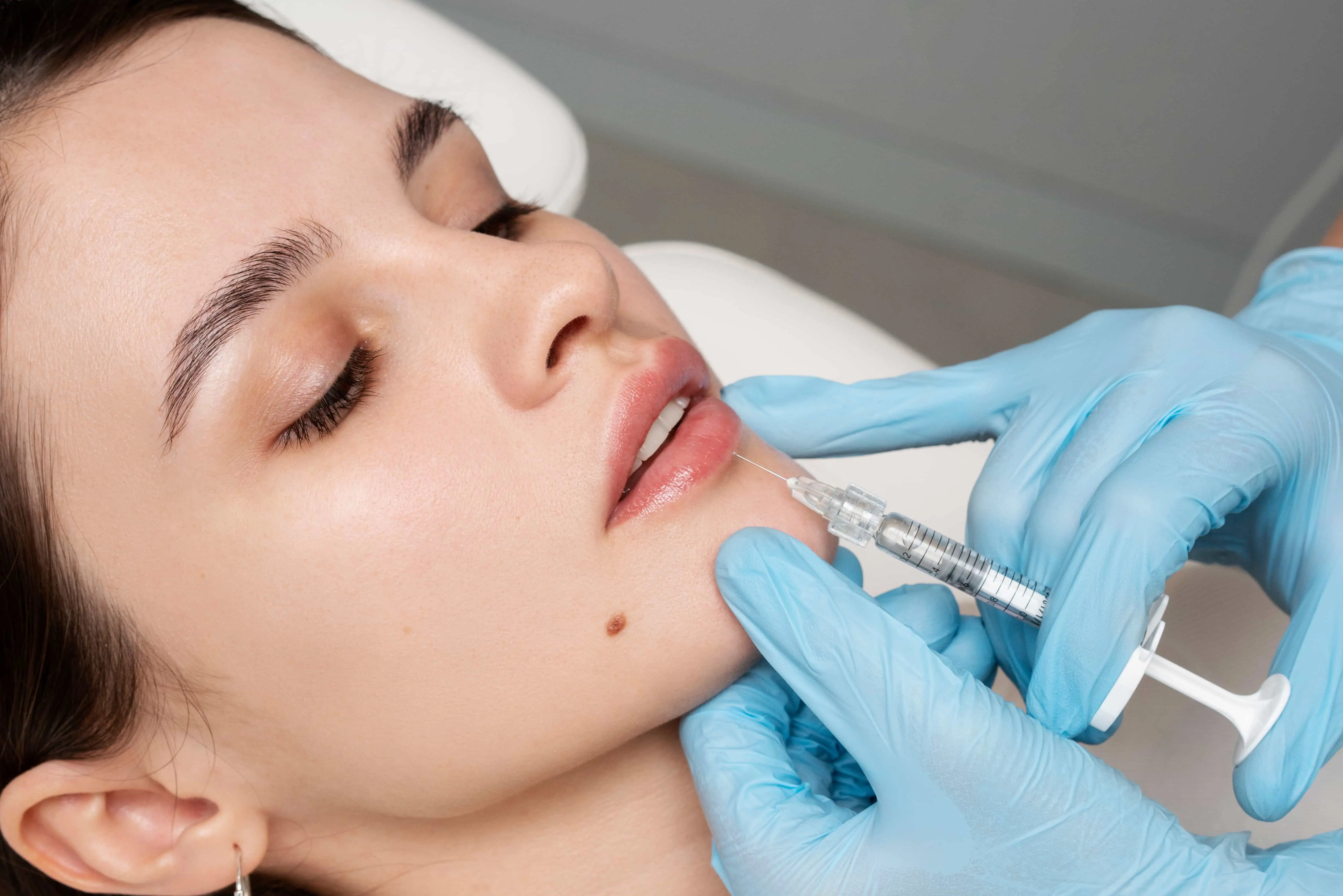 Gingival and facial aesthetic application at Avenue Dental clinic