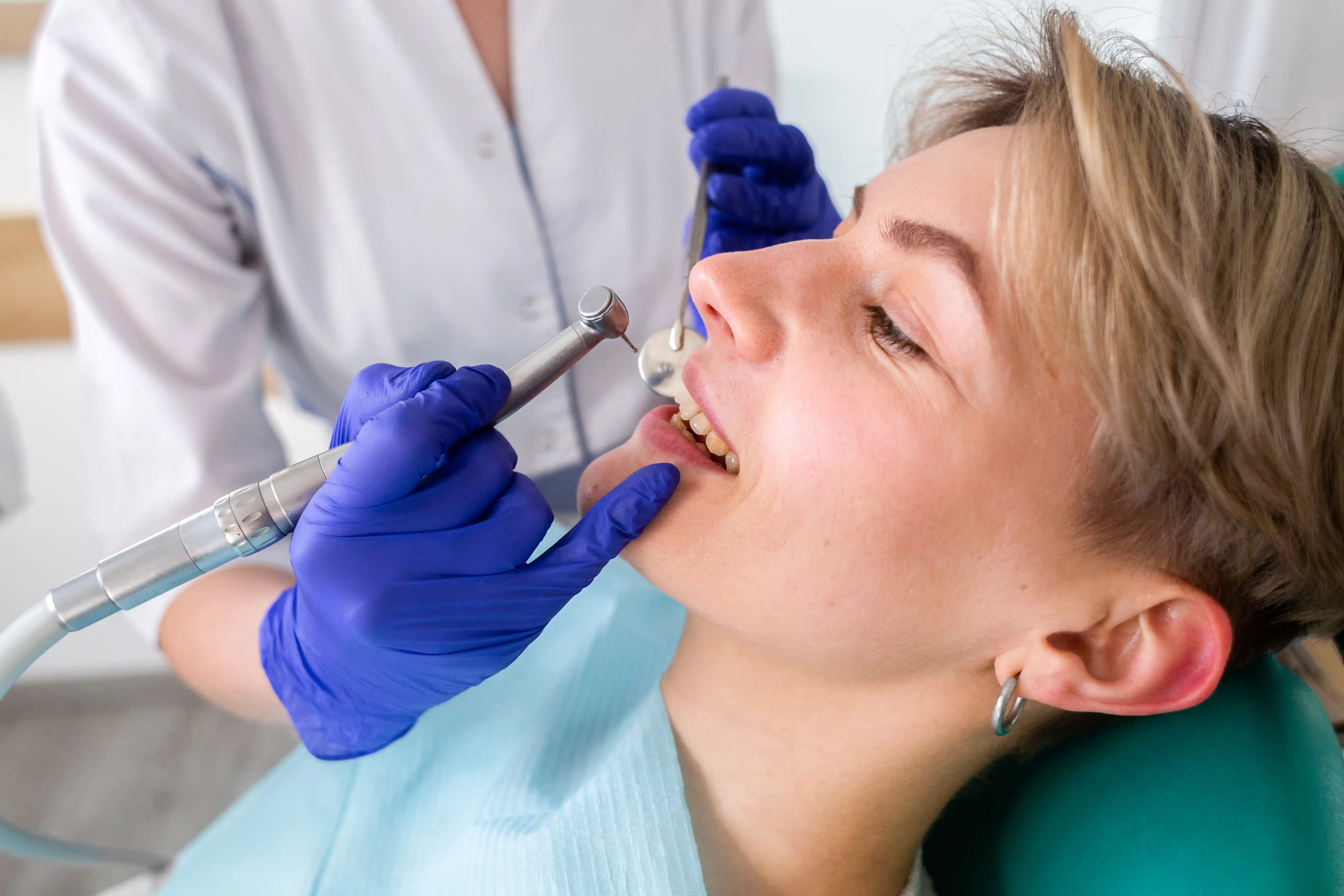 Aesthetic filling procedure in progress at Avenue Dental clinic