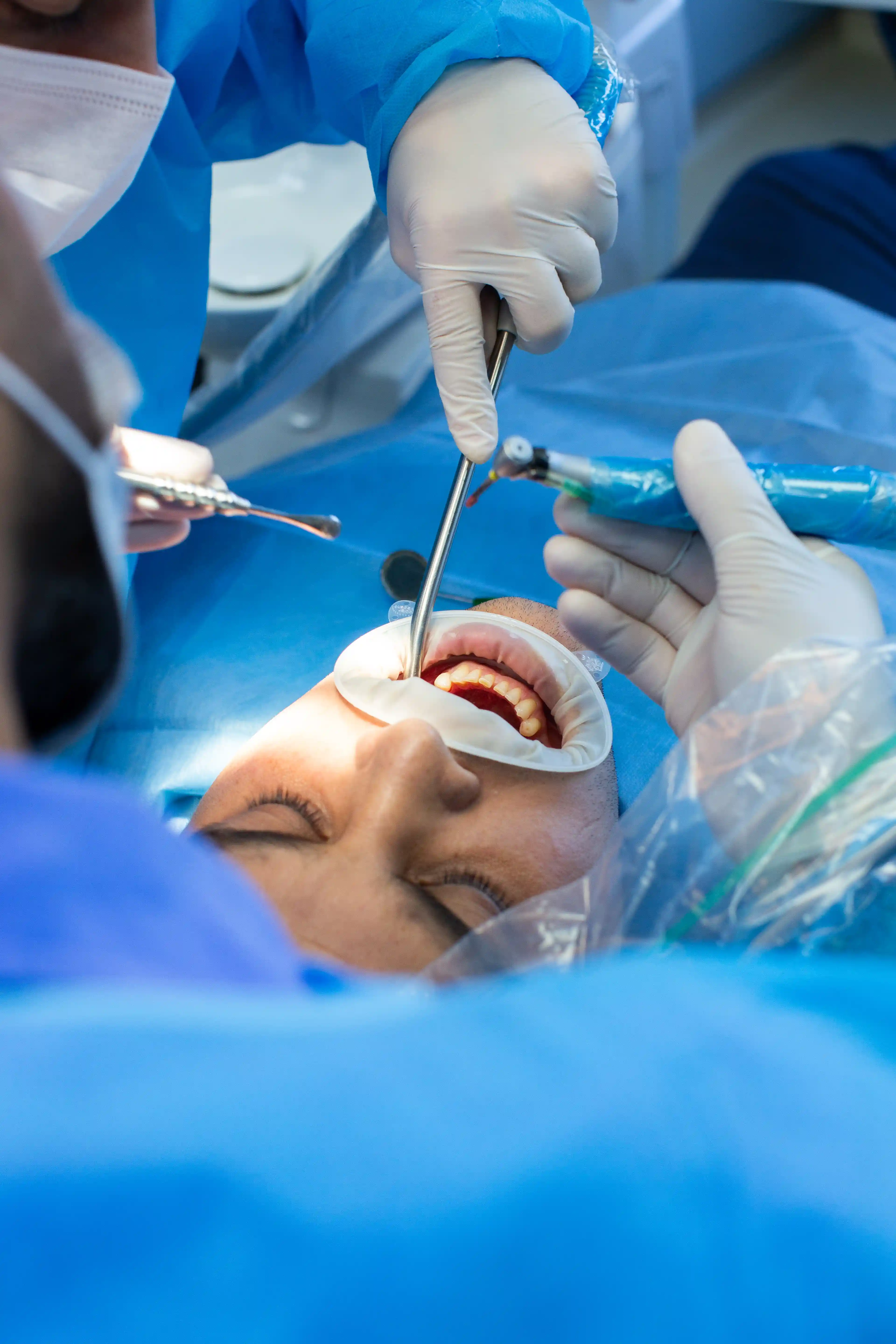 Carefully performed oral surgery and surgical dental procedure