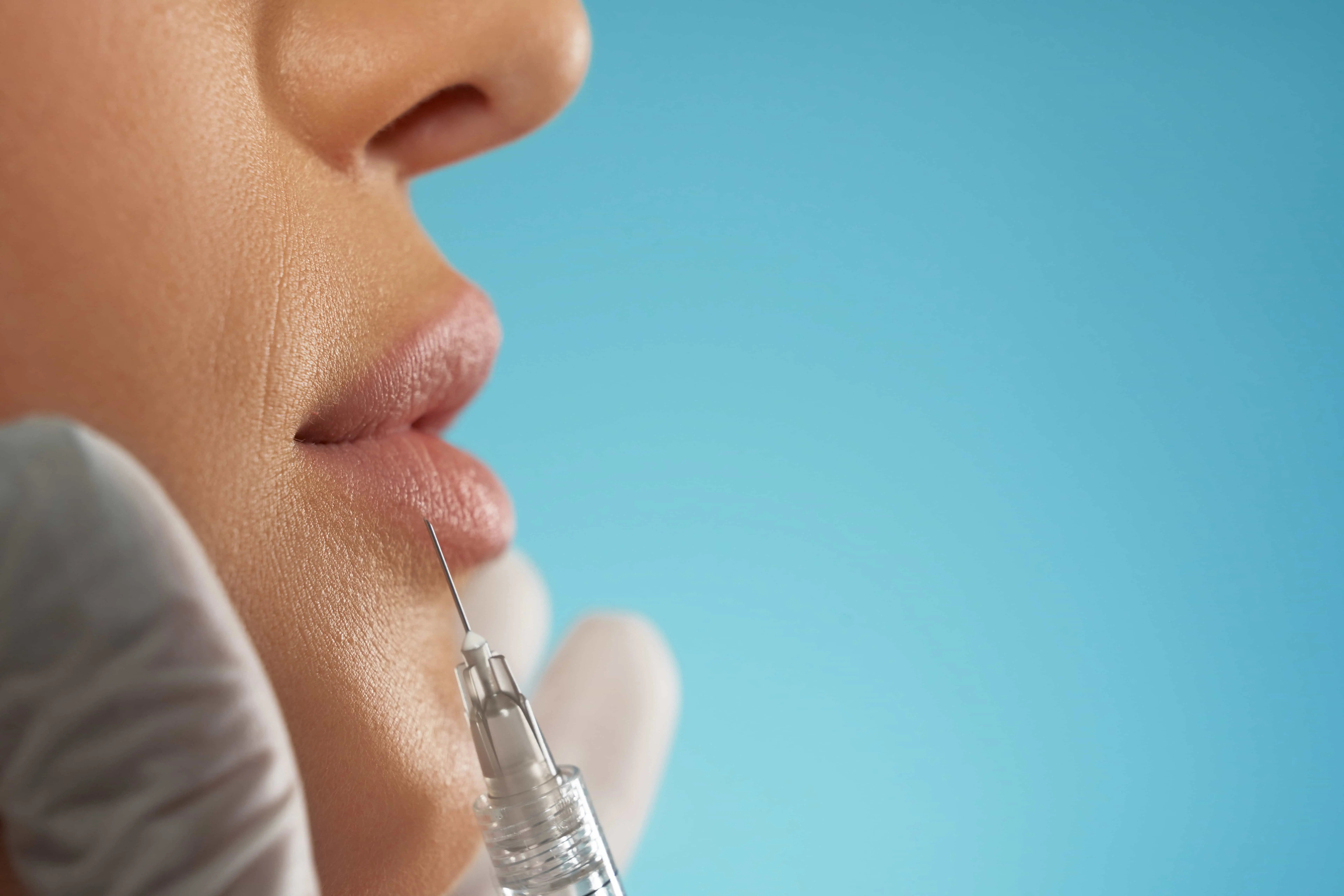 Precise aesthetic treatment performed at Avenue Dental clinic