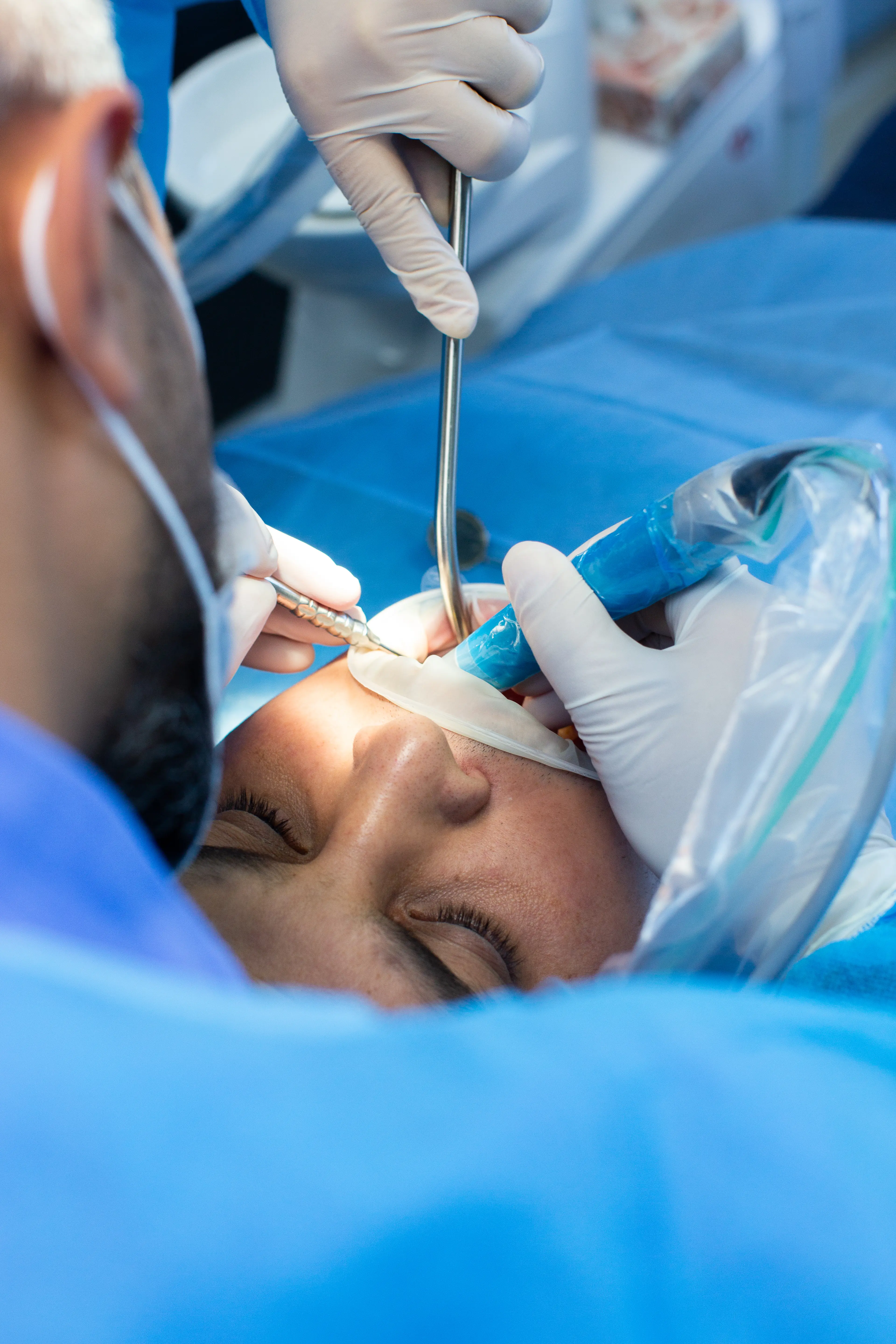 Fogászati sebészeti beavatkozás precíz elvégzése az Avenue Dental klinikán