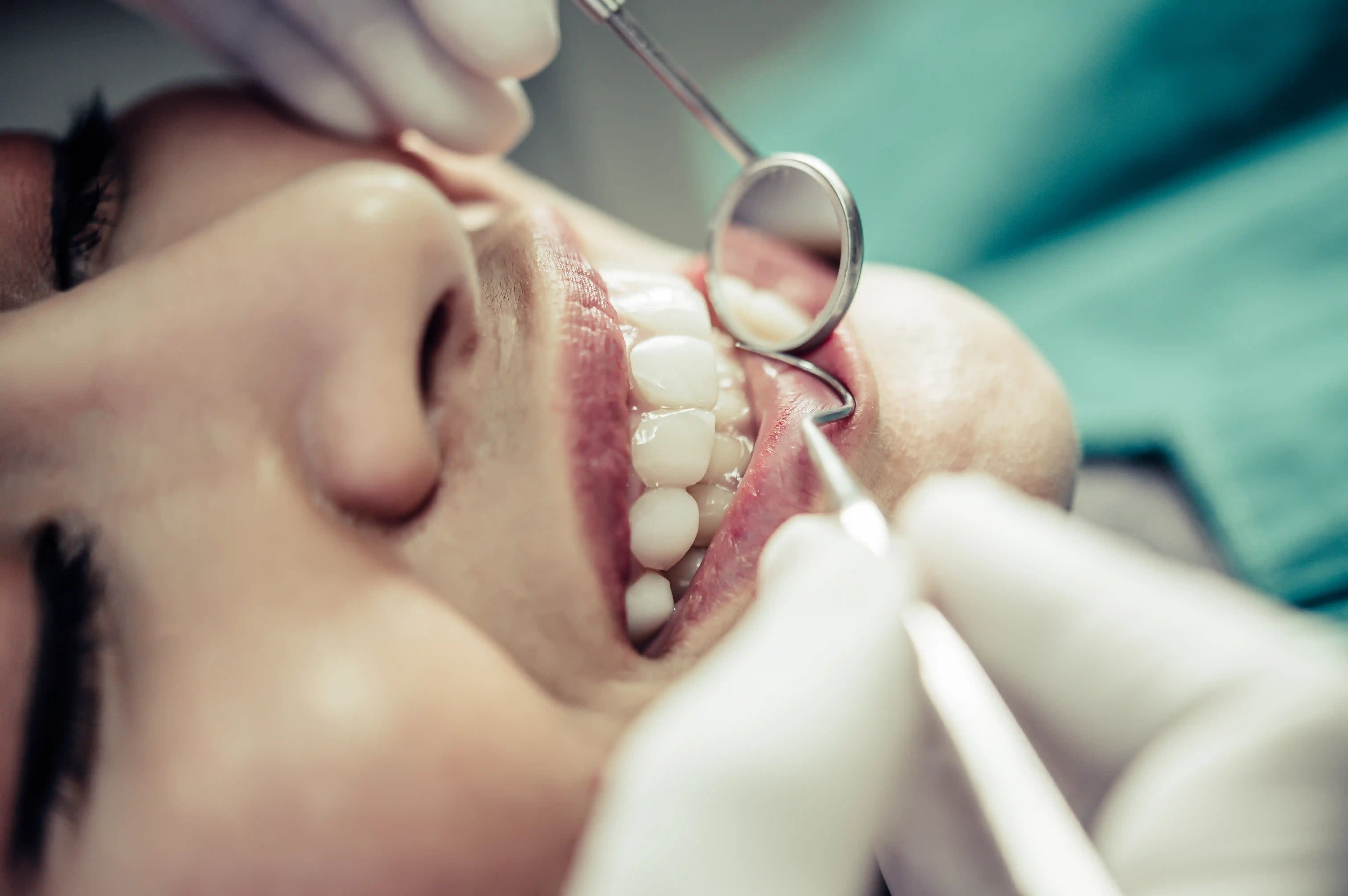Dental examination and cavity check at Avenue Dental Budapest