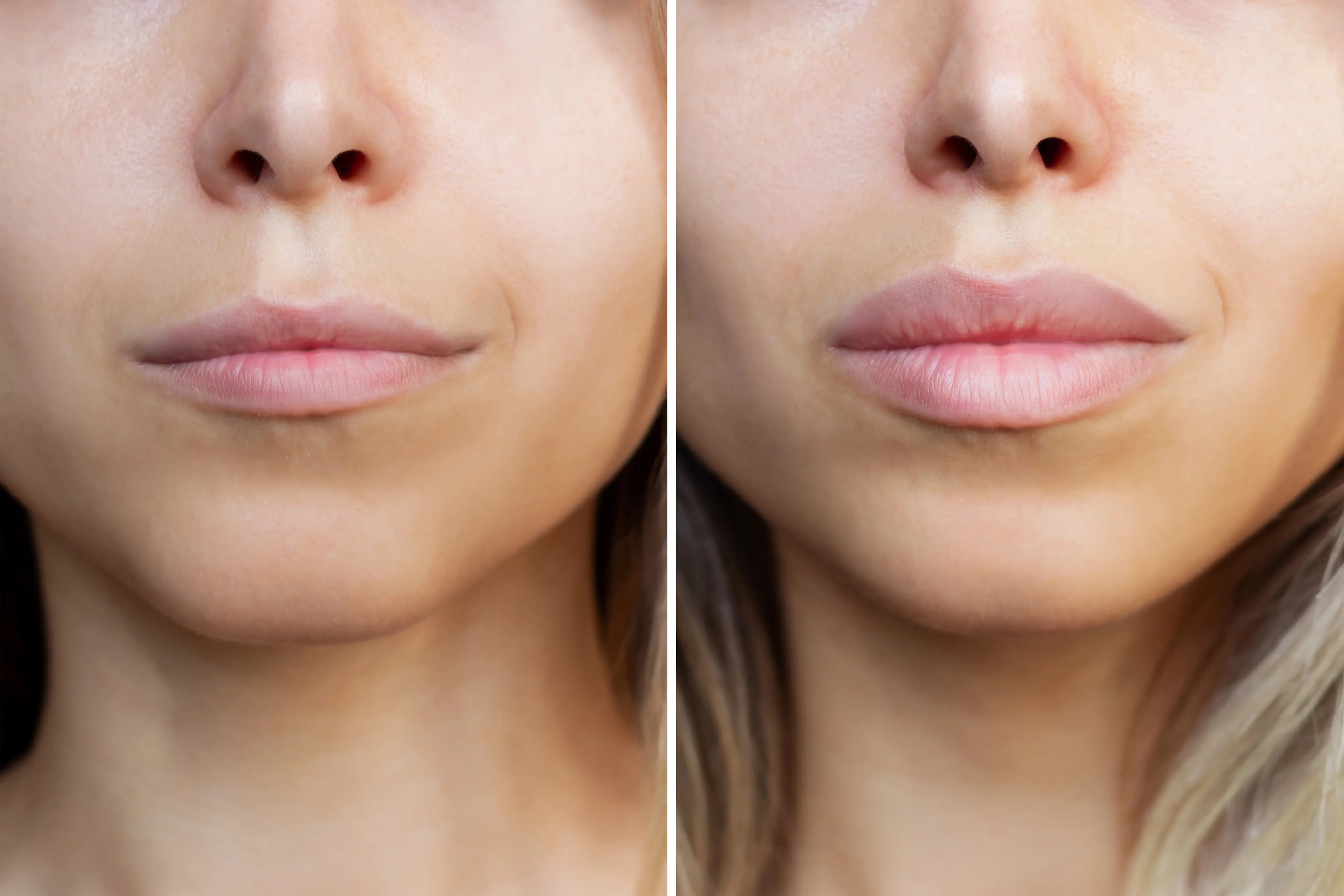 Natural harmony and subtle enhancement following facial aesthetic care
