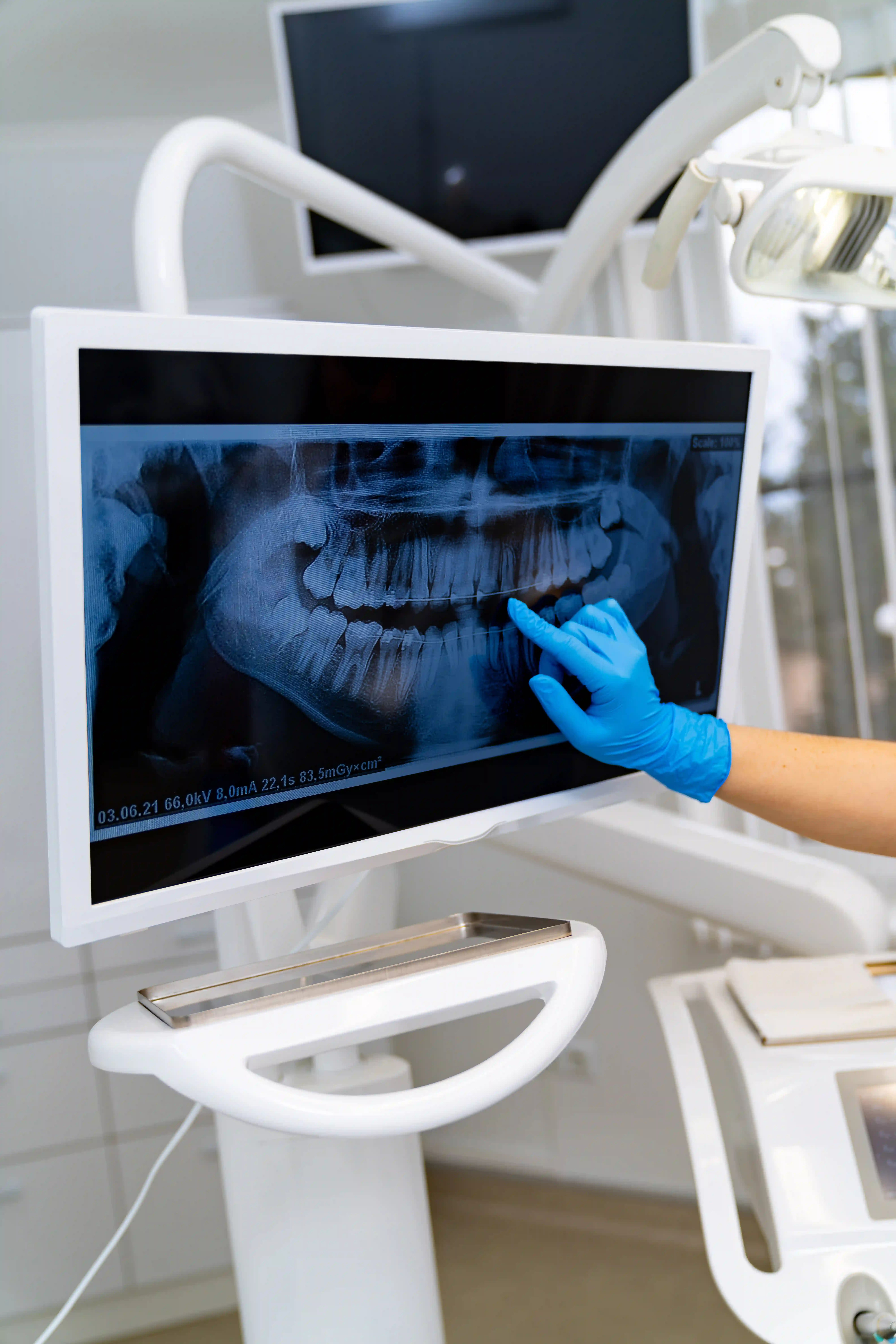 Általános kezelések, állapotfelmérés és vizsgálat az Avenue Dentalban
