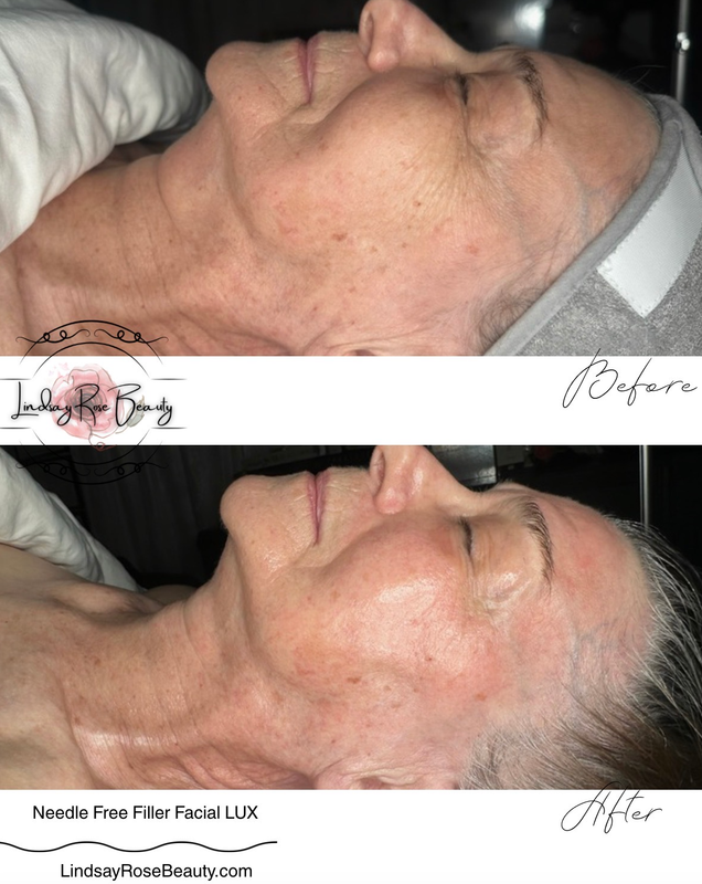 Real client before & after — sculpting massage contour