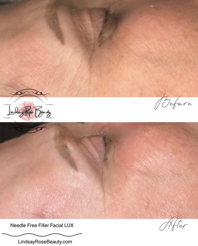 Real client before & after — radiant skin transformation