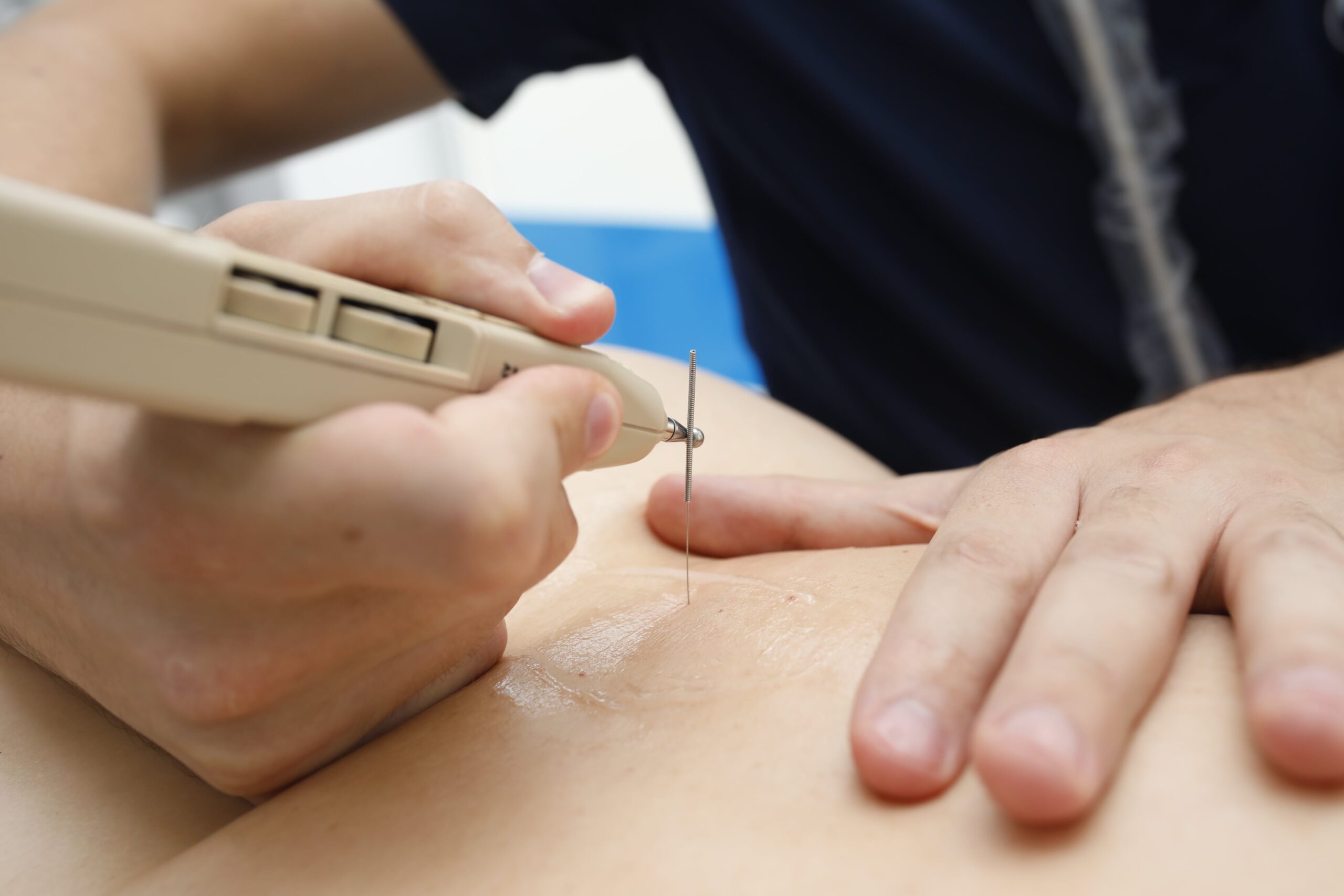 Fisioterapia invasiva en Silvente Fisioterapia