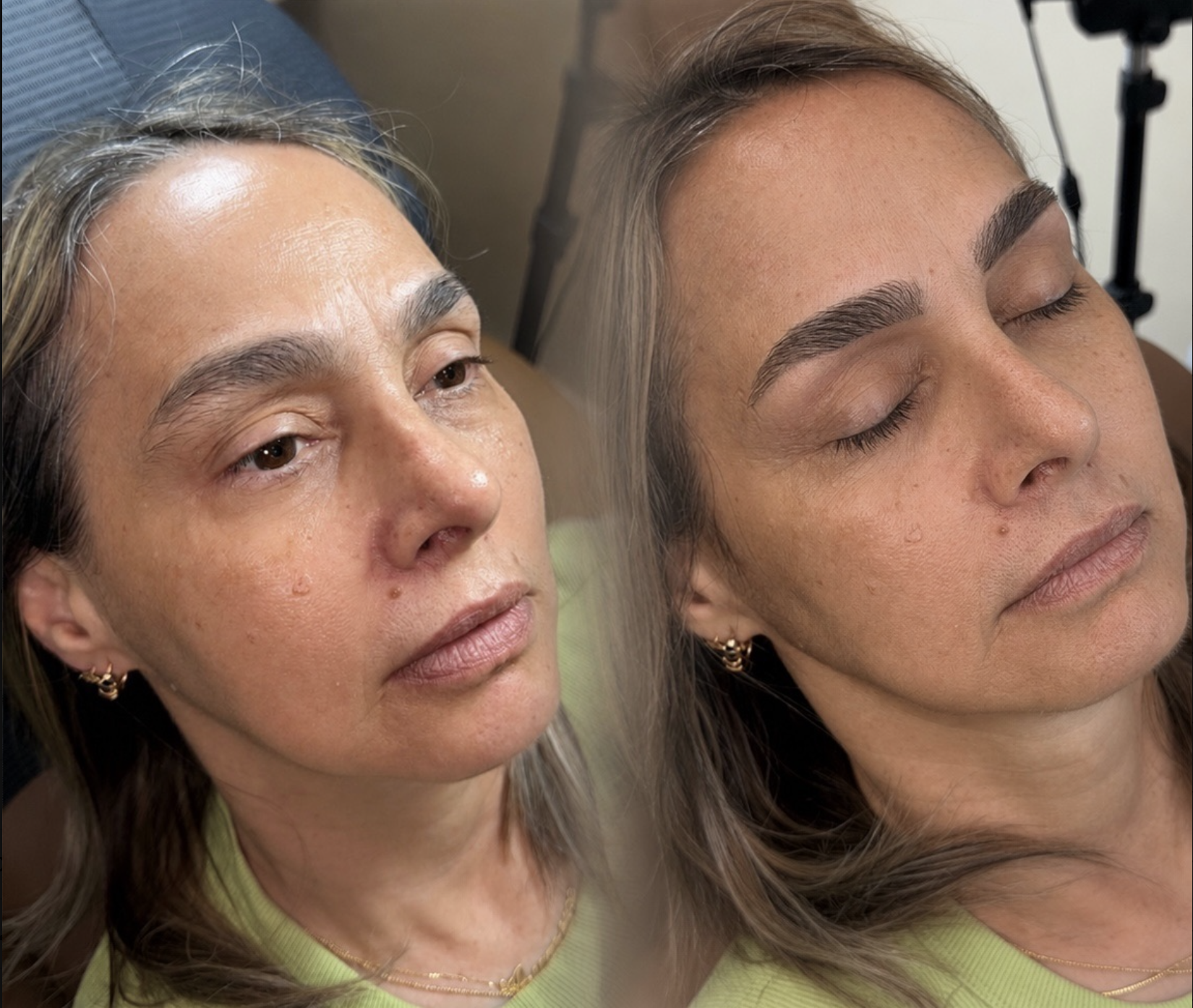 Resultado real de Carmen R., 58 años