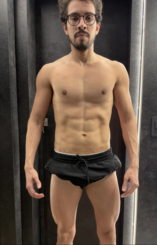 Foto do Depois - Caso #2