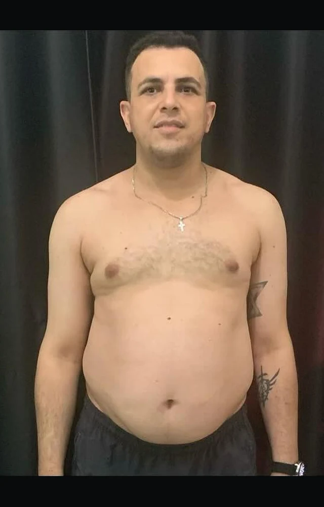 Foto do Antes - Caso #3