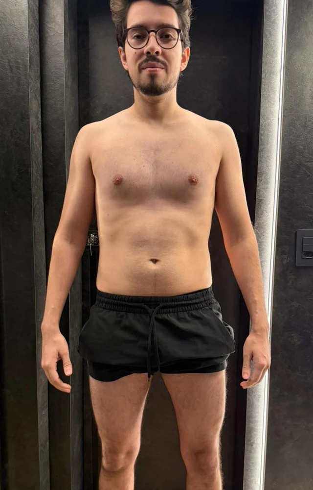 Foto do Antes - Caso #2