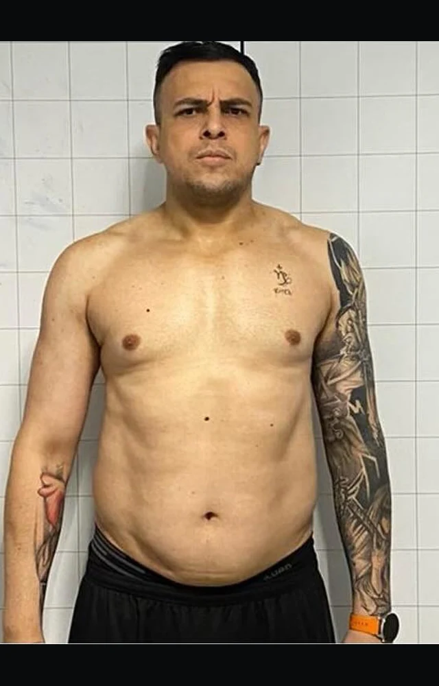Foto do Depois - Caso #3