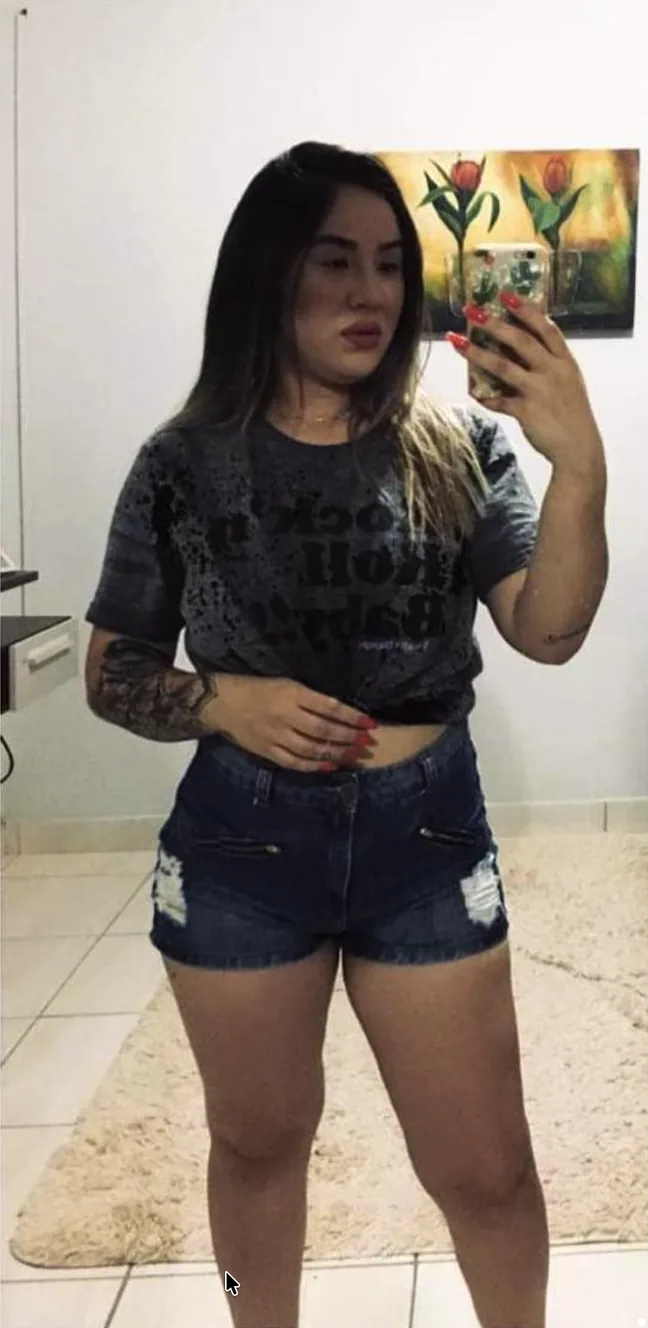 Foto do Antes - Caso #4
