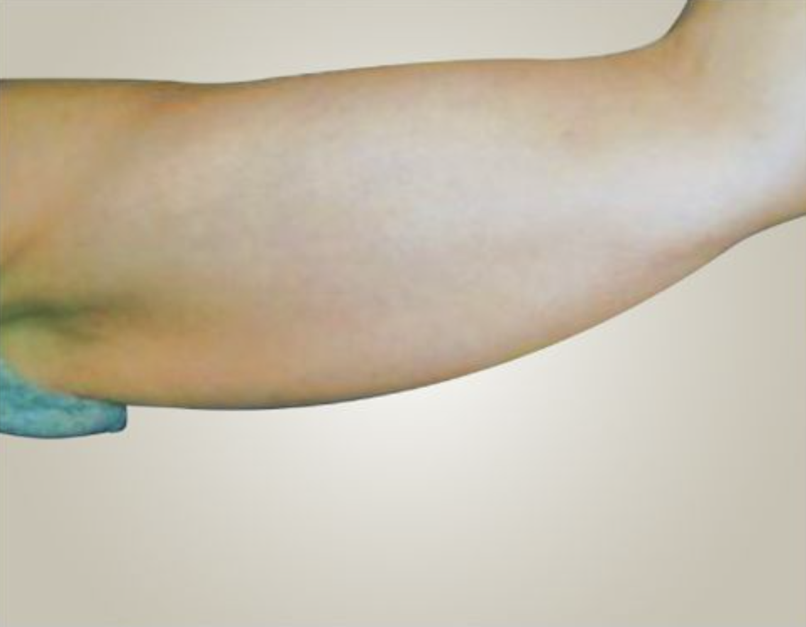 Arms After
