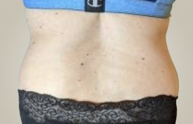 Love handles After