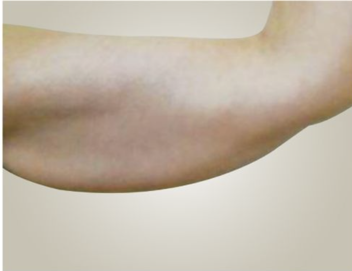 Arms Before