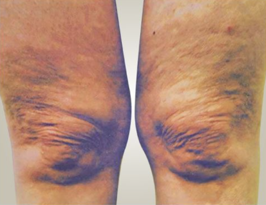 Knees Before