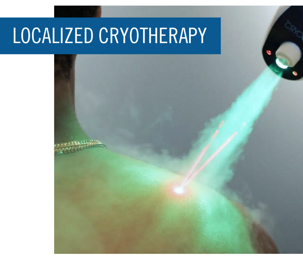 Localized Cryotherapy at Icebox Tallahassee