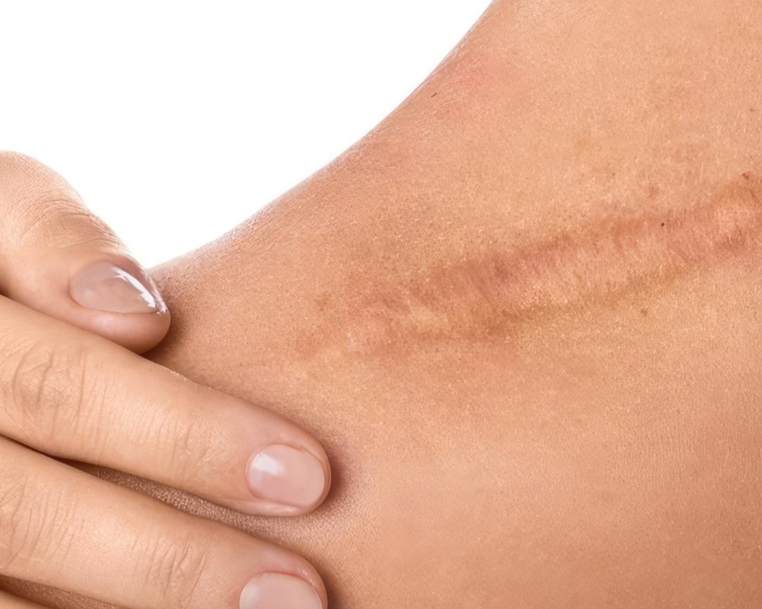 Wound Care & Healing