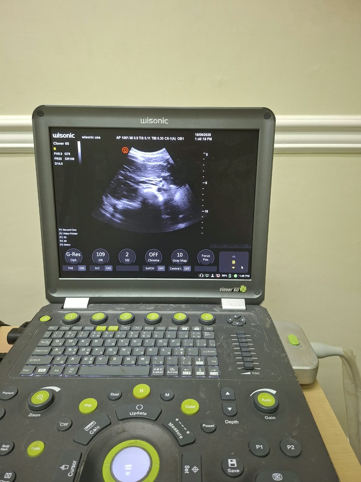 High-resolution ultrasound imaging screen display at Precision Imaging