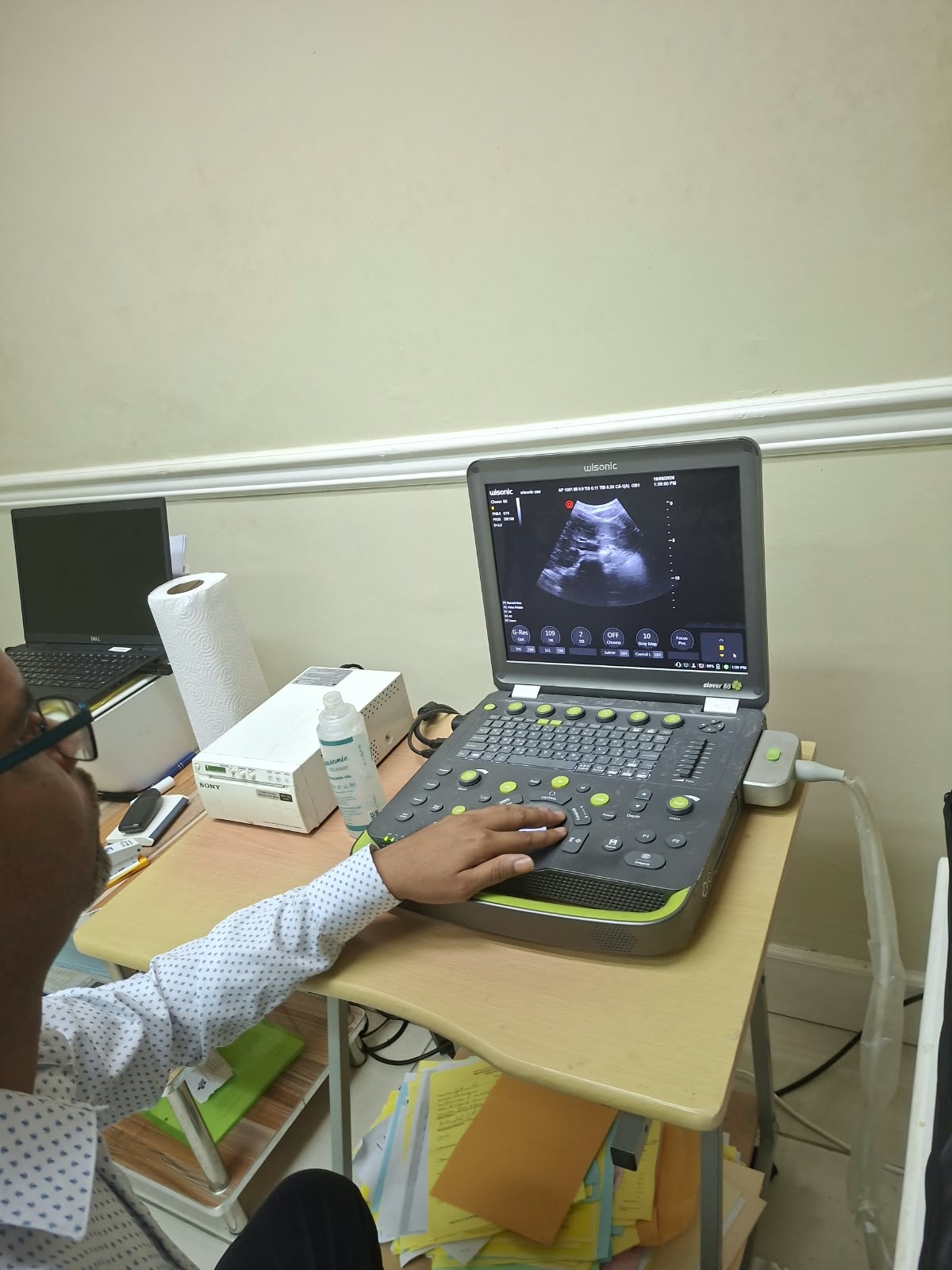 Wisonic Clover 60 diagnostic ultrasound console in use at Precision Imaging