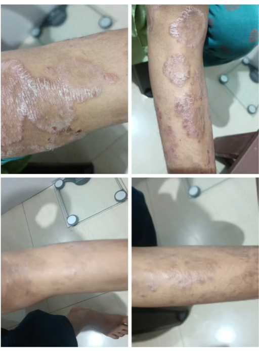 Ayurvedic skin care progress documentation