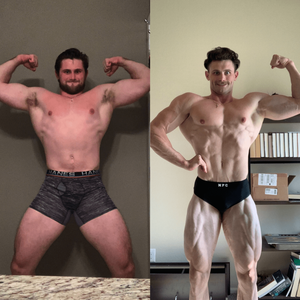 Trevor transformation