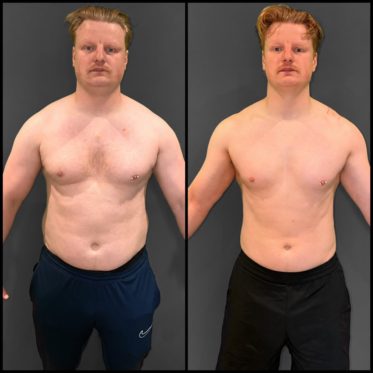 Jack Thompson Transformation - Front View