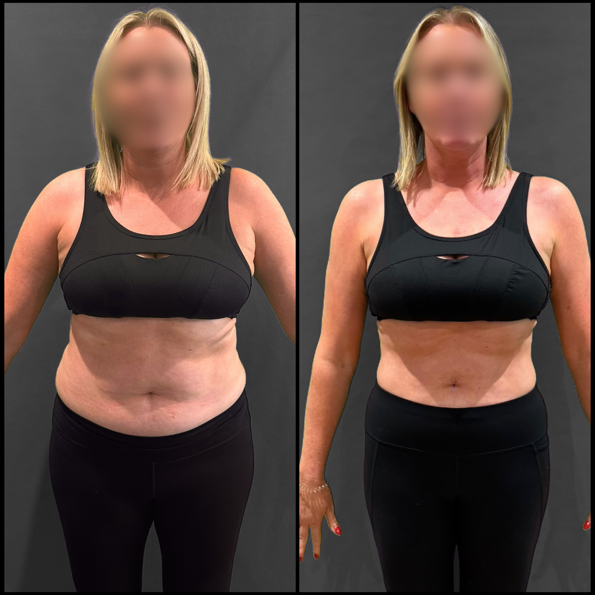 Joanne Allan Transformation - Front View