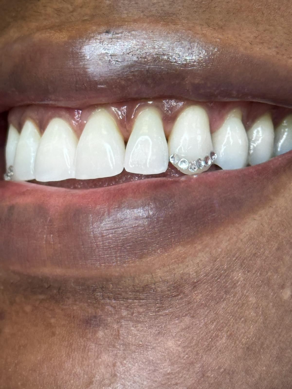 Beautiful smile with tooth gem cluster